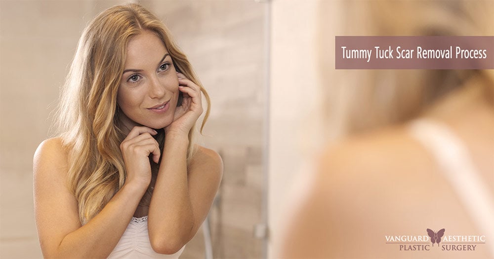 What’s the Procedure for a Tummy Tuck Scar Removal?