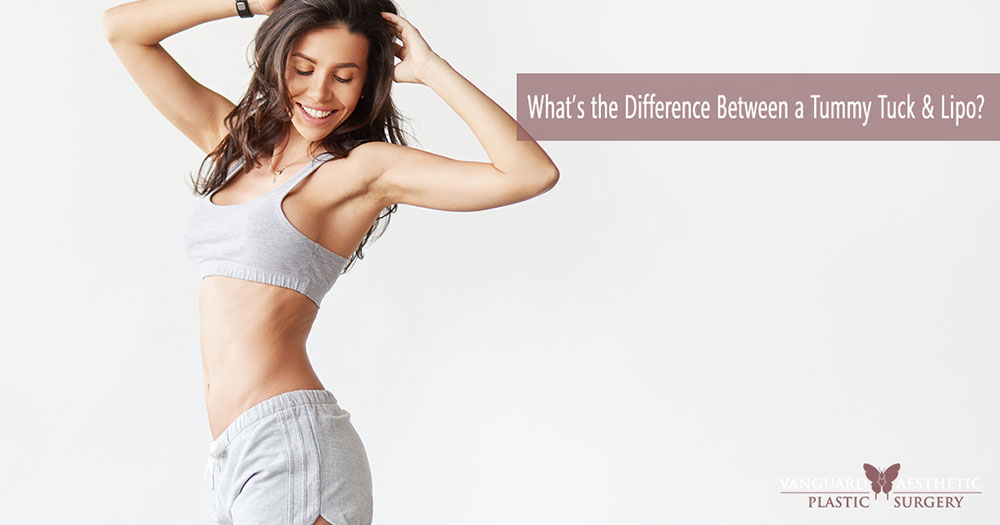 What is the Difference Between a Tummy Tuck & Liposuction?